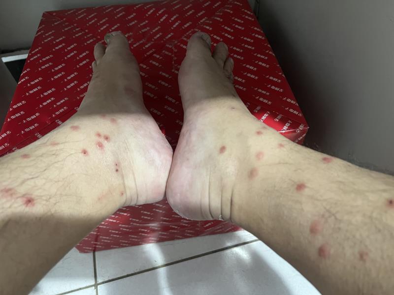 跳蚤橫行雙腳滿滿「紅豆冰」! 民眾: 工程一動縫隙裡跳蚤全跑出