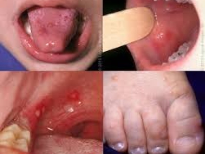 新生兒腸病毒重症致死 今年第2例 專家籲準爸媽加強防護