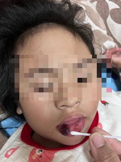 台東特幼班虐童案引眾怒 立委、家長齊聲譴責 要求教育部徹查