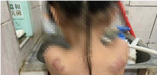 關山「幼兒園學童不當對待案」6童受害 認定4人施暴依法提起公訴