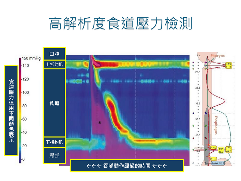 食道壓力檢測圖.png